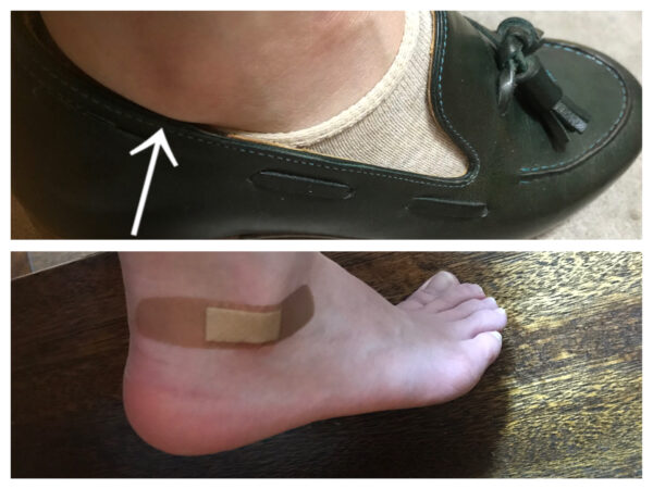足が 靴 の中で 擦れる 痛くなる原因を紹介 シューケア マイスター